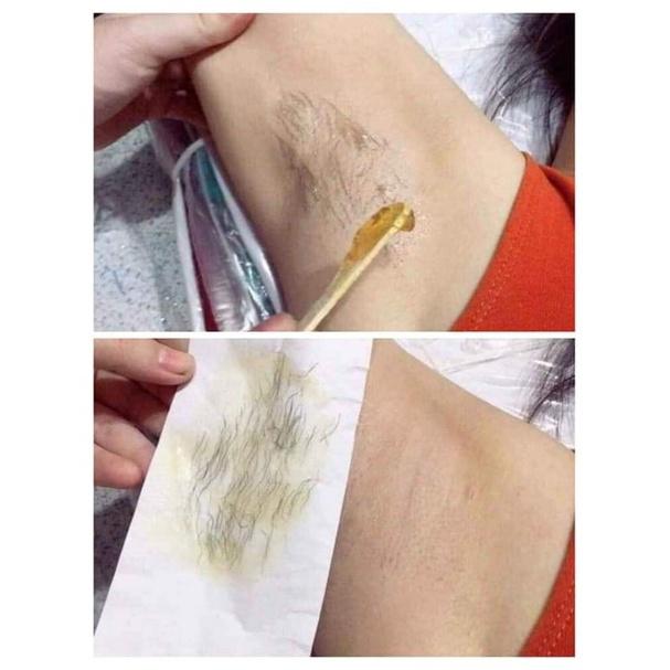 Combo Triệt lông Wax Shiny và Mỡ Trăn Shiny Handmade