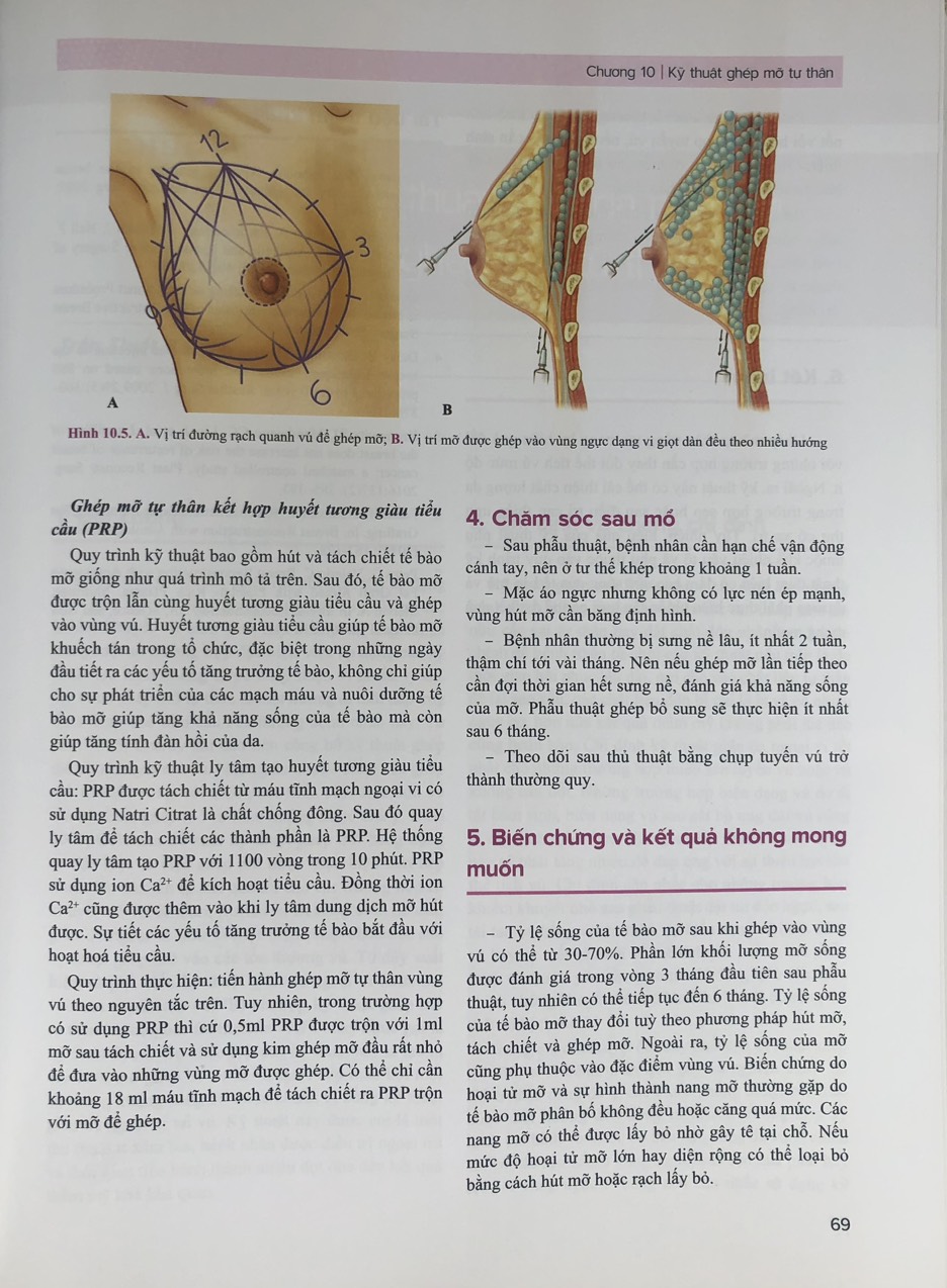 Sách - Atla.s Phẫu thuật tạo hình thảm mỹ vú(Tập 1)