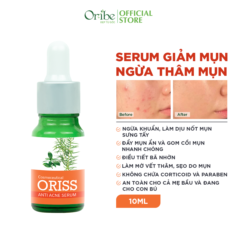 Serum Ngừa Mụn Dưỡng Trắng Da Oriss Cao Cấp