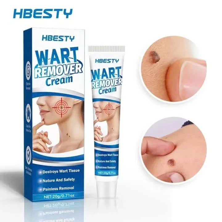 Kem Mụn Cóc, Mụn Thịt, Mụn Cơm Hiệu Quả – Chiết Xuất Thảo Dược An Toàn 20g, ĐÈN TRANG TRÍ , ĐỒNG HỒ TREO TƯỜNG