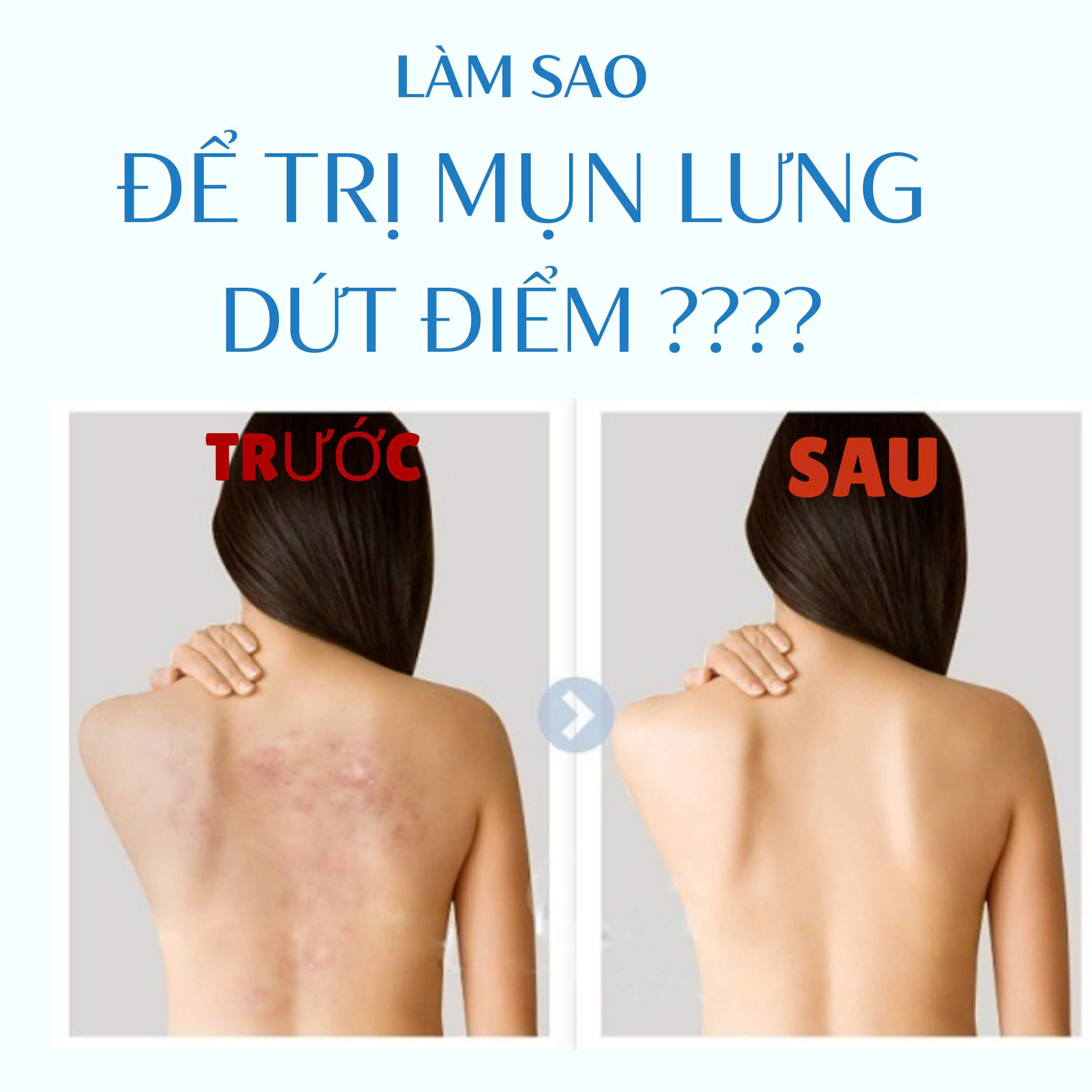 Pelican Phiên Bản Mini Xà Phòng Tắm Ngừa Mụn Vùng Lưng For Back Soap Bar 50g