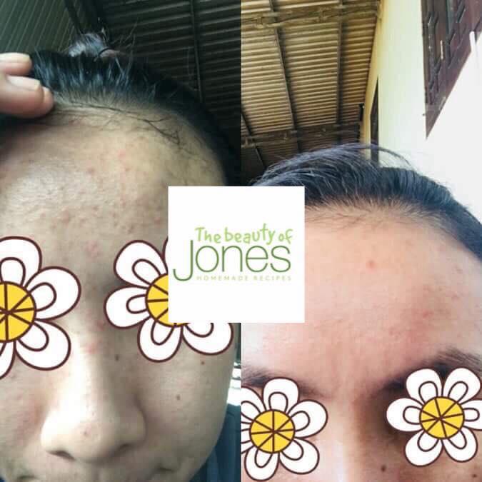 Toner hoa cúc dành cho mẹ bầu The Beauty of Jones 100gr