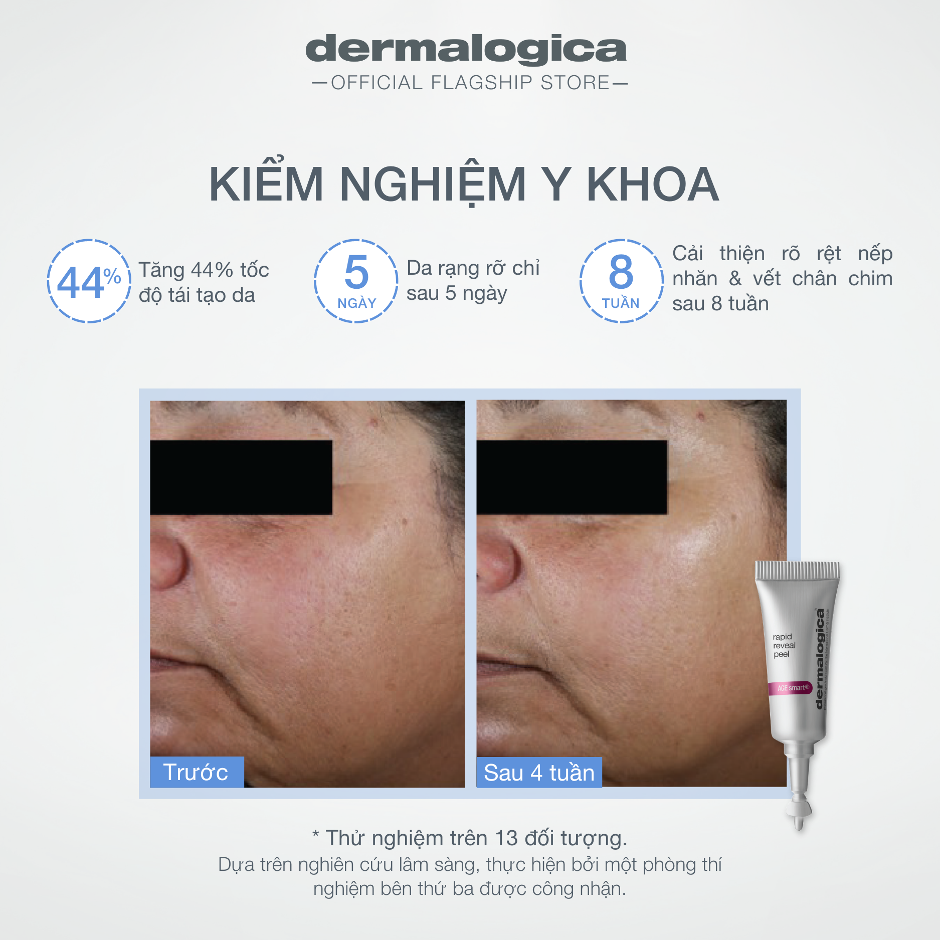 Tẩy da chết hoá học Dermalogica Rapid Reveal Peel 30ml làm mượt, làm sáng da