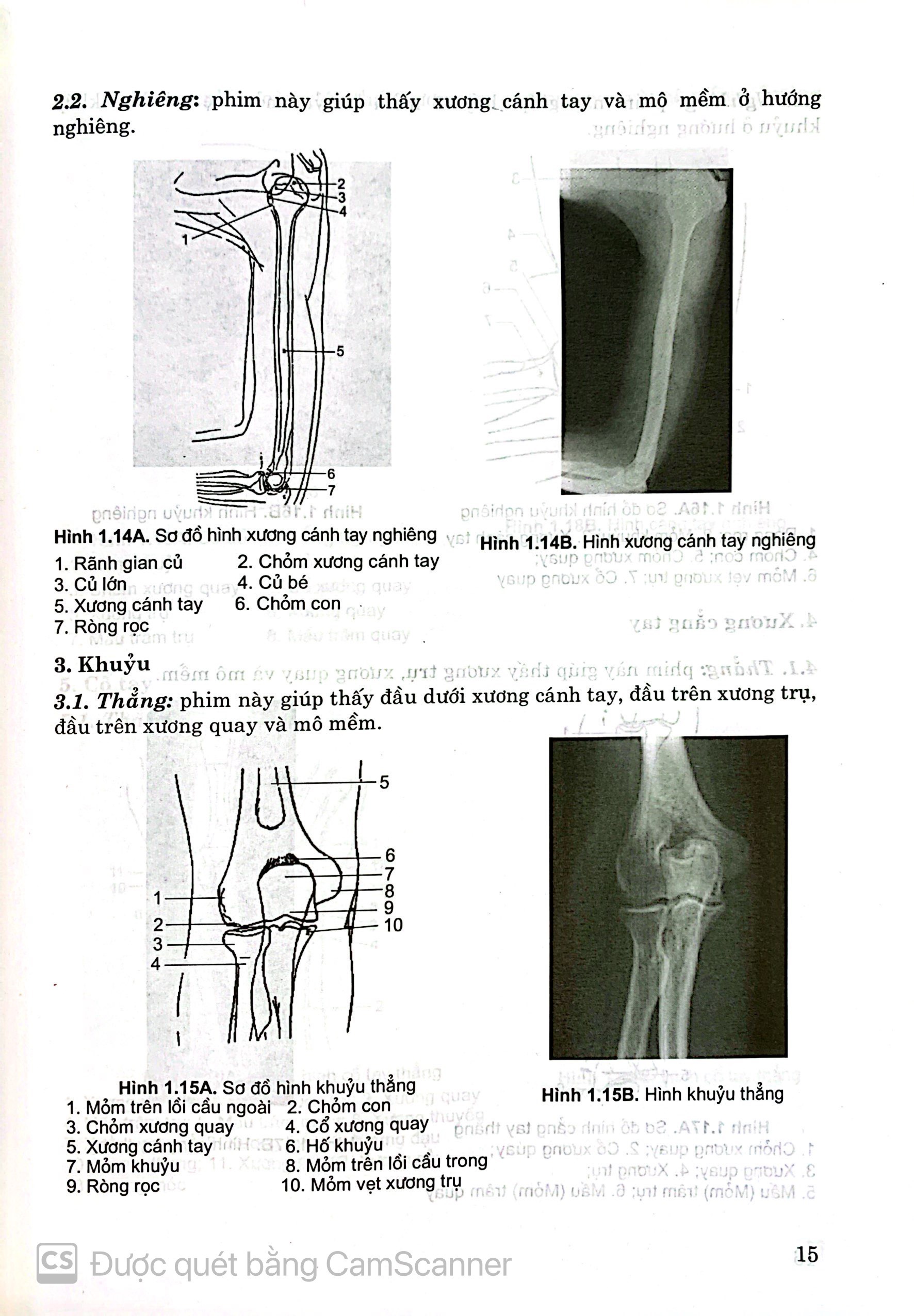 Hình ảnh Benito - Sách - Giải phẫu X quang - NXB Y học