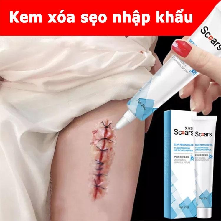 Kem xóa sẹo, loại bỏ hiệu quả các vết sẹo lâu năm, sẹo phẫu thuật, phục hồi và làm sáng các vết rạn da khi mang thai, xó