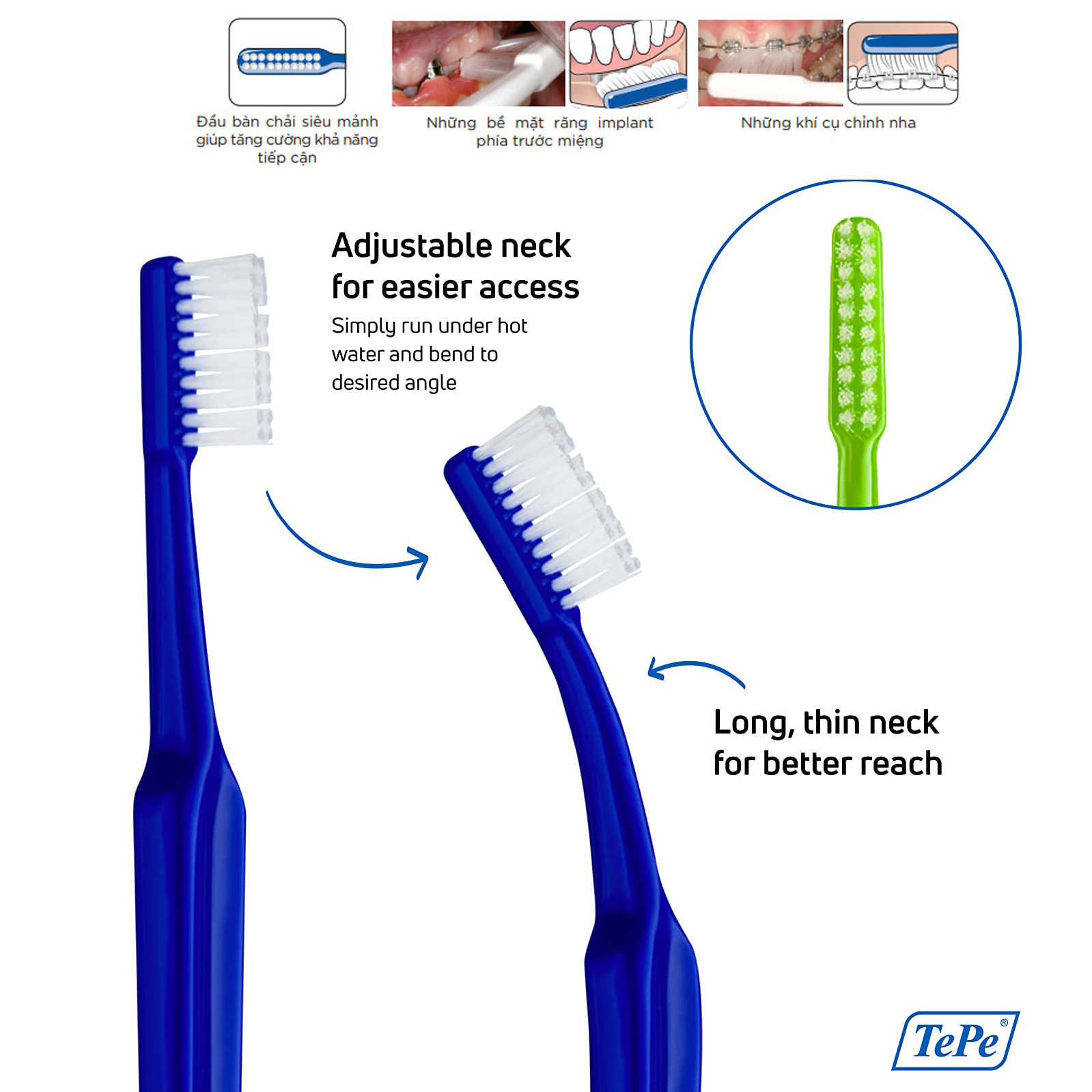 Bàn chải đánh răng chuyên biệt cho người niềng răng, chỉnh nha, răng implant Tepe Implant Orthodontic - Màu ngẫu nhiên