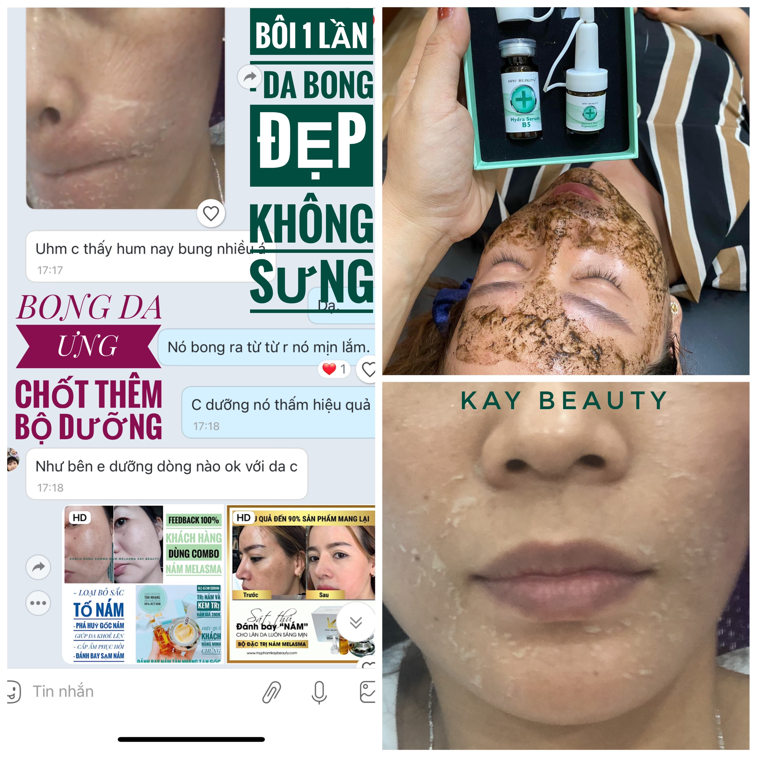 PEEL RETINOL VI KIM TẢO thay mới làn da - không sưng - không đỏ - HỘP QUÀ TẶNG CHO CHỊ EM