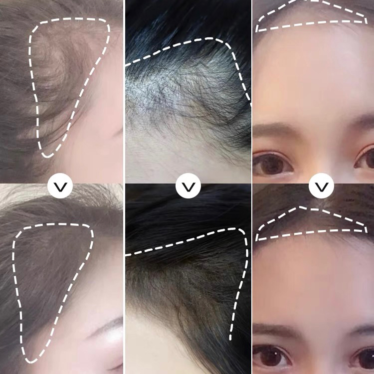 Phấn Che Hói Che Khuyết Điểm Cho Tóc