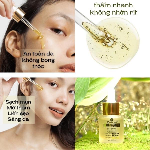 Serum Giảm Mụn Doctor Care Serum Mụn Đầu Đen Cho Da Dầu 20 ml