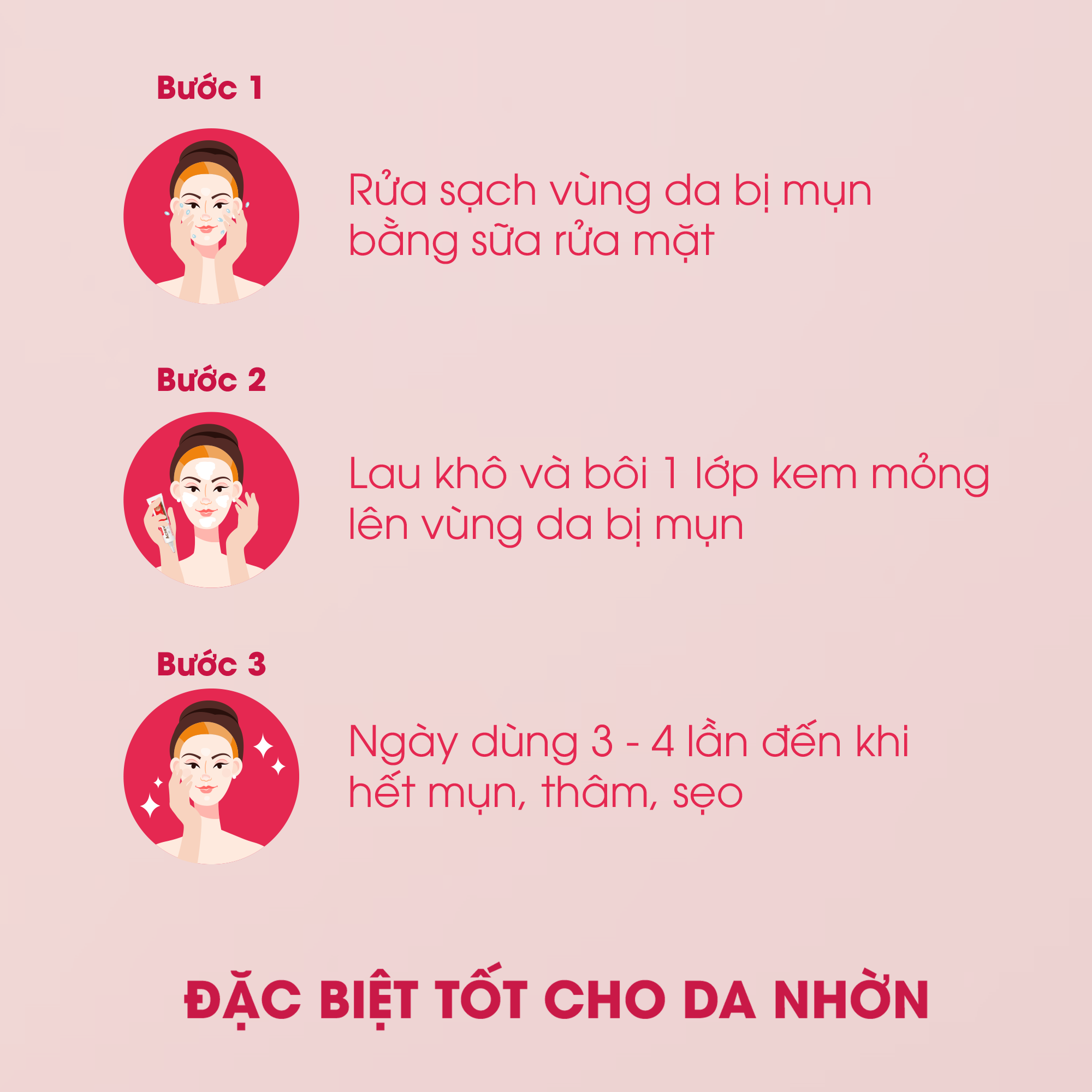 Kem ngừa mụn Acnevir Santafa - Ngăn ngừa và giảm mụn, cải thiện nhanh tình trạng viêm đỏ của mụn cám, mụn đầu đen - Tuýp 15g