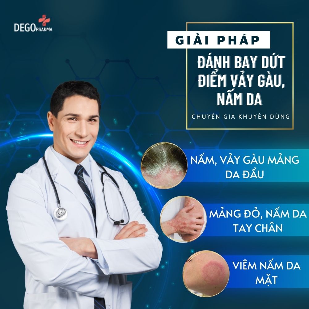 Combo dầu gội &amp; kem bôi dứt điểm nấm da, vảy nến, á sừng Dego Pharma