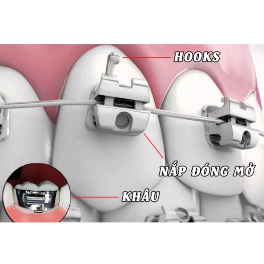 Hook 1.3mm_DTC _Dùng trong nha khoa_Niềng răng_Chỉnh nha