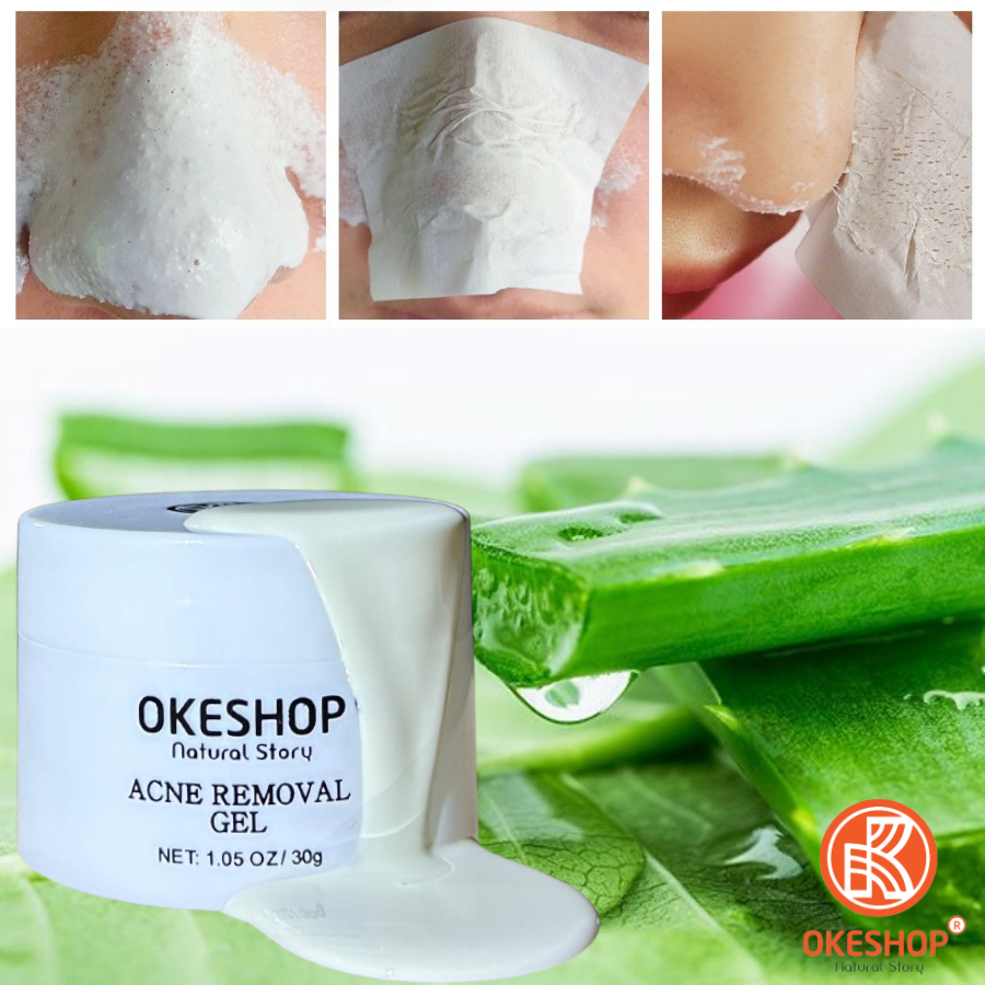 Giấy Lột Mụn Cám - Mụn Đầu Đen OKESHOP - Giải Pháp Cùng Gel Lột Mụn OKESHOP 600 tờ