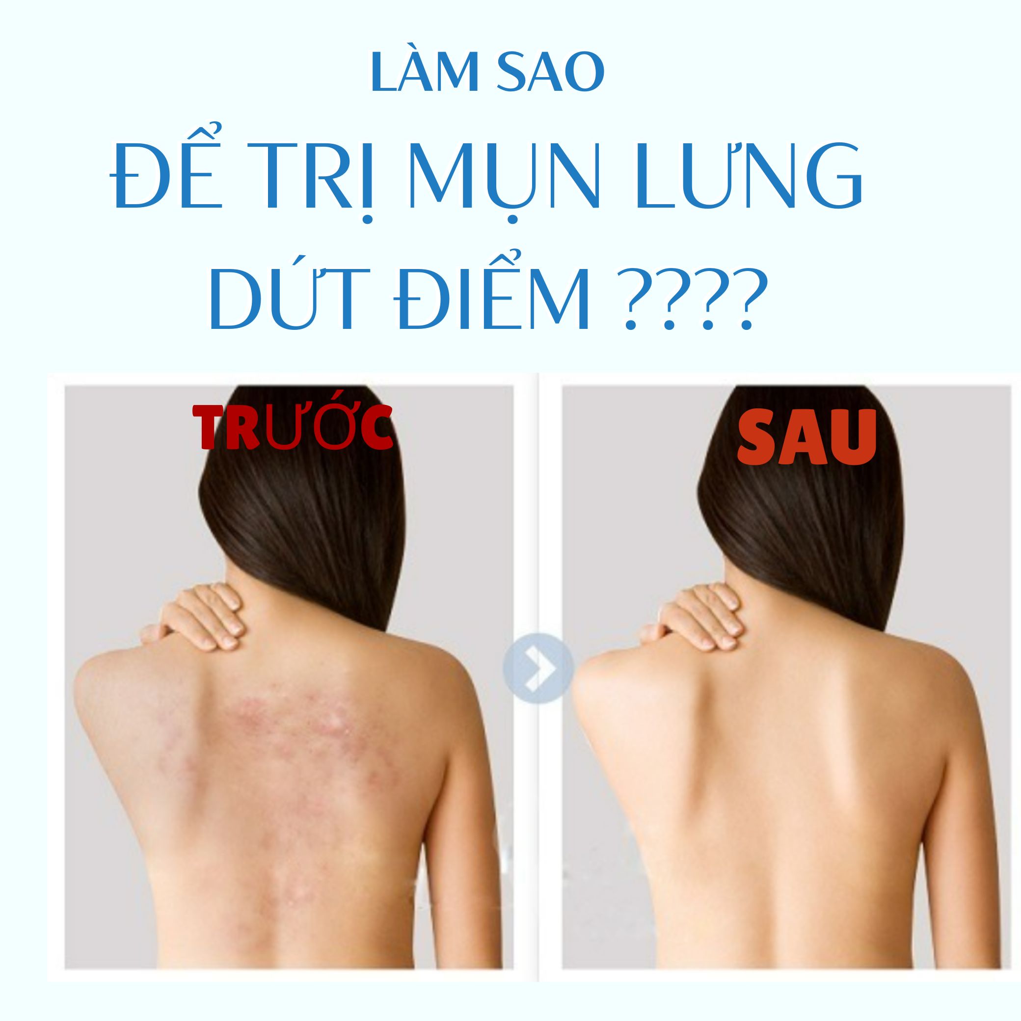 Xà Phòng Tắm Ngừa Mụn Vùng Lưng Pelican For Back Soap Bar (135G)