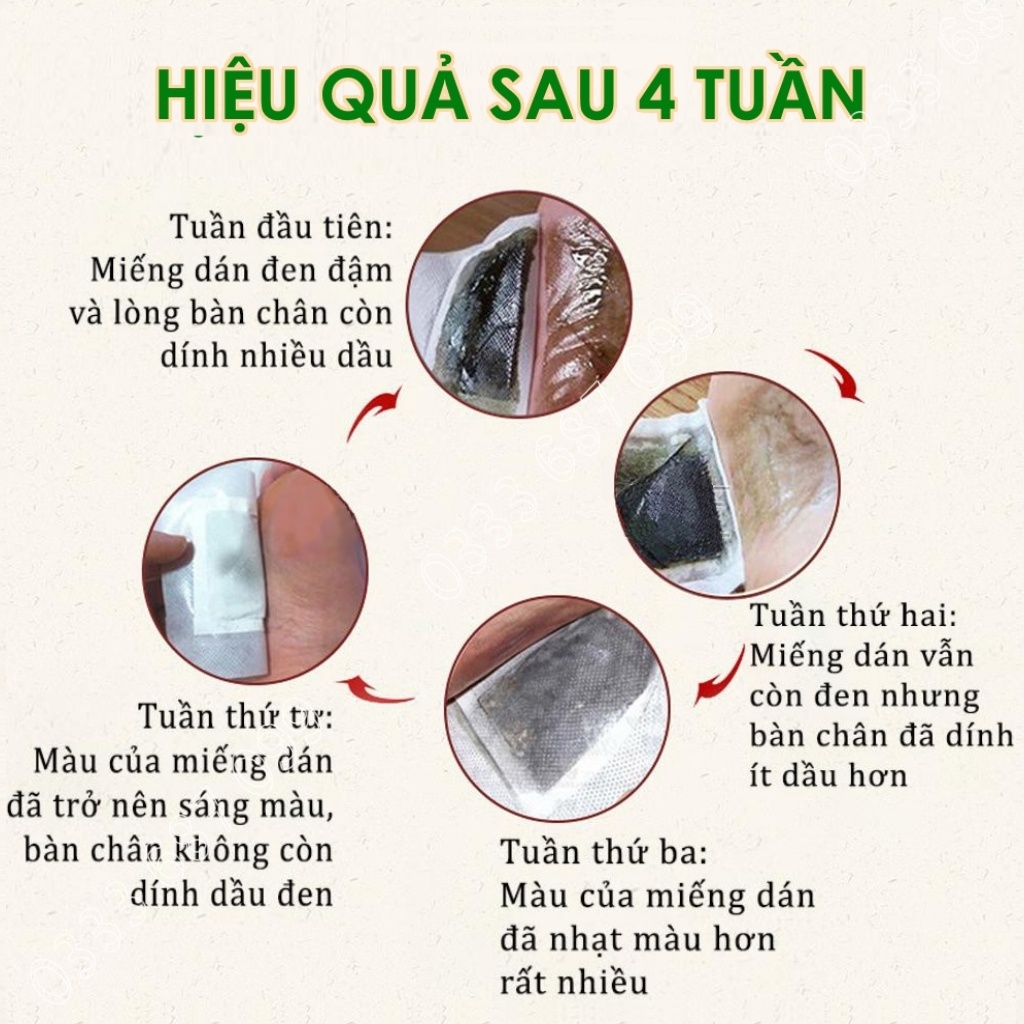 (Combo)Hộp 50 miếng dán thải độc bàn chân và hộp 12 miếng ngải cứu thắt lưng,vai gáy