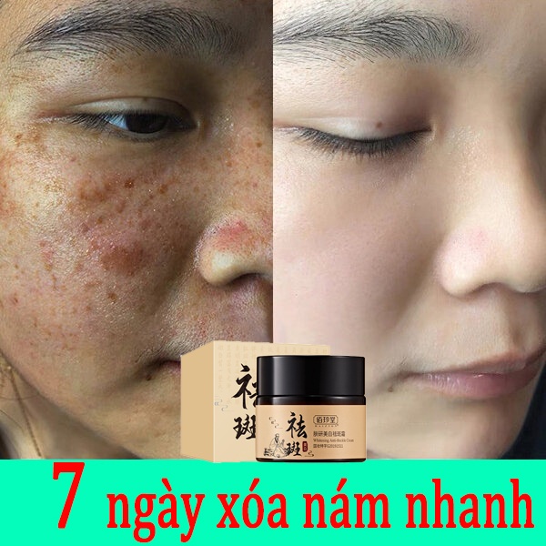 Kem dưỡng trắng da xóa nám tàn nhang đốm đen chống oxy hóa hiệu quả sau 7 ngày từ thảo dược loại tốt