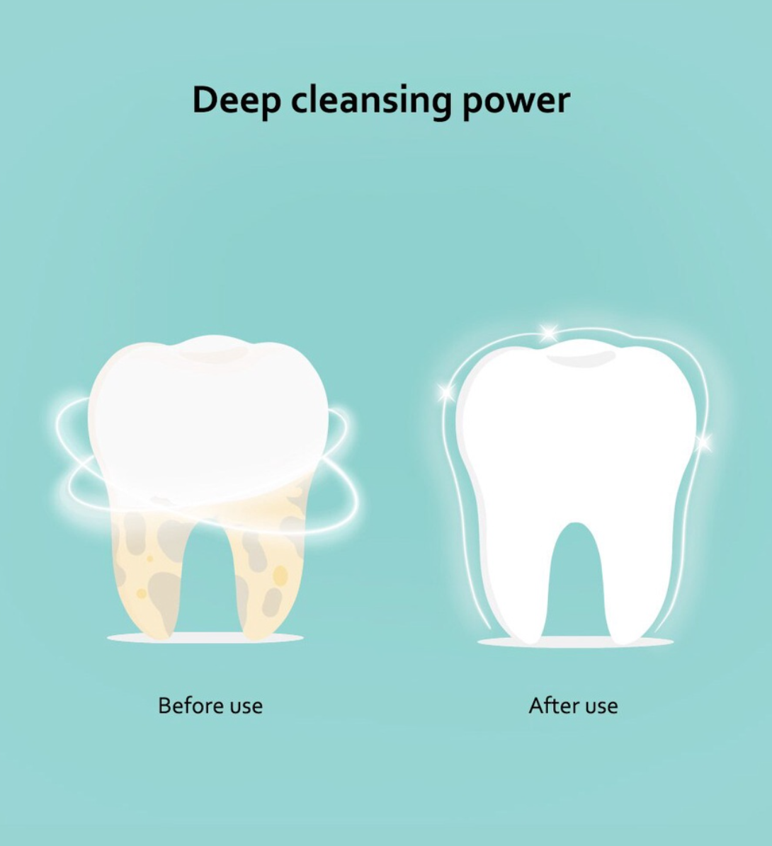 Máy cạo vôi răng bằng siêu âm Xiaomi YC2 Tooth Calculus Remover Nha sĩ làm trắng răng Vệ sinh răng miệng