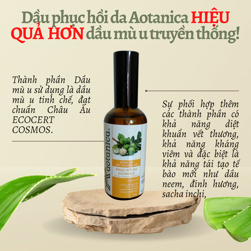 Dầu phục hồi da bỏng &amp; vết thương hở Aotanica 20ml