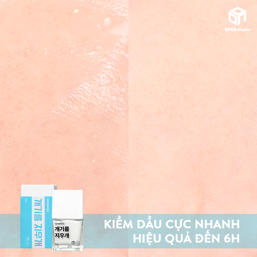 Kem kiềm dầu SKINMISO OIL ERASER