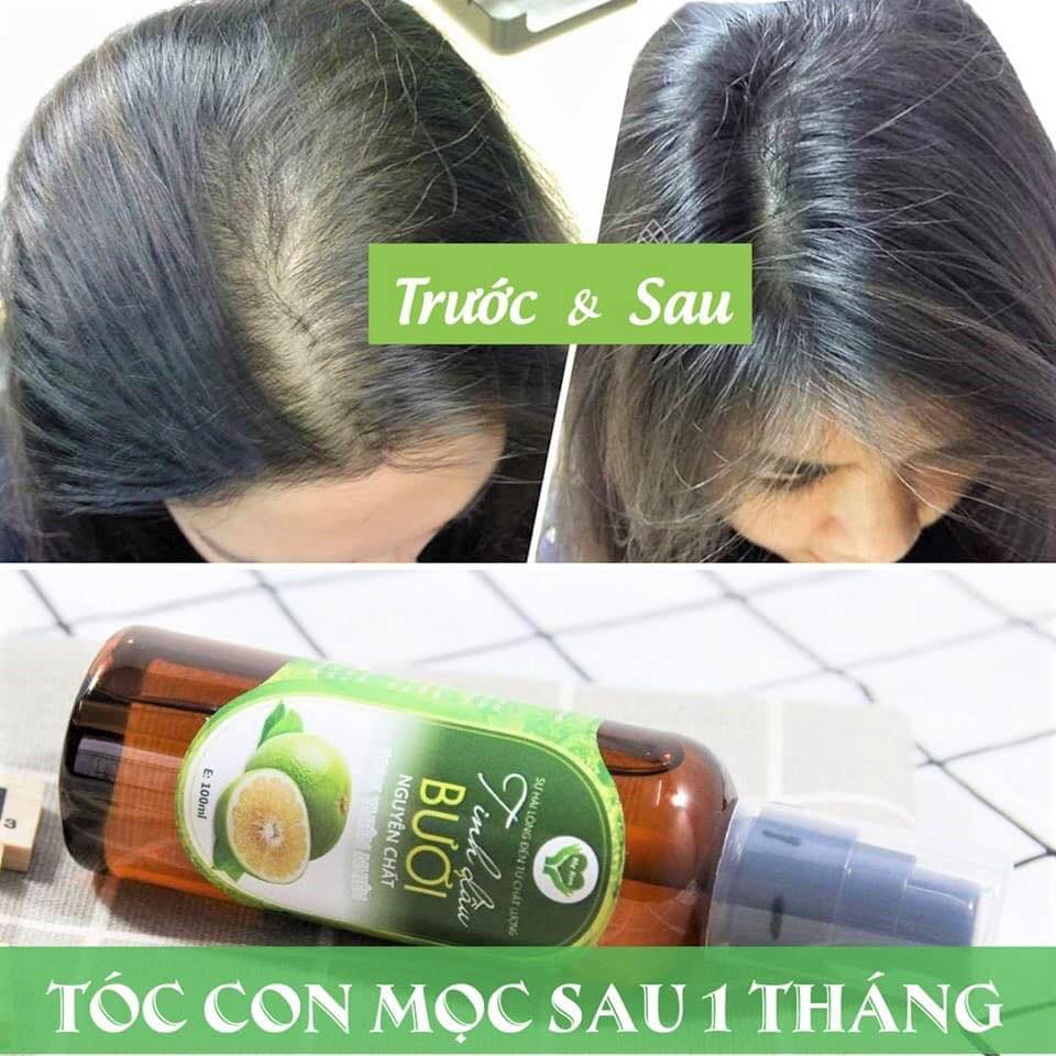 TINH DẦU BƯỞI NGUYÊN CHẤT MẸ KEN- 100 ML ( Kích thích mọc tóc, giảm rụng tóc, suôn mượt)