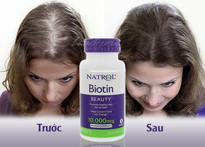 Biotin mọc tóc Natrol Beauty Mỹ hỗ trợ tóc mọc nhanh hơn, dày hơn, cho mái tóc khỏe mạnh, làn da rạng rỡ và móng tay chắc khỏe - QuaTangMe Extaste