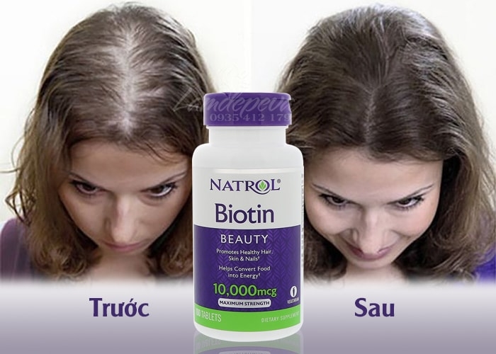 Viên Uống Hỗ Trợ Mọc Tóc, Móng Natrol Biotin 10.000mcg