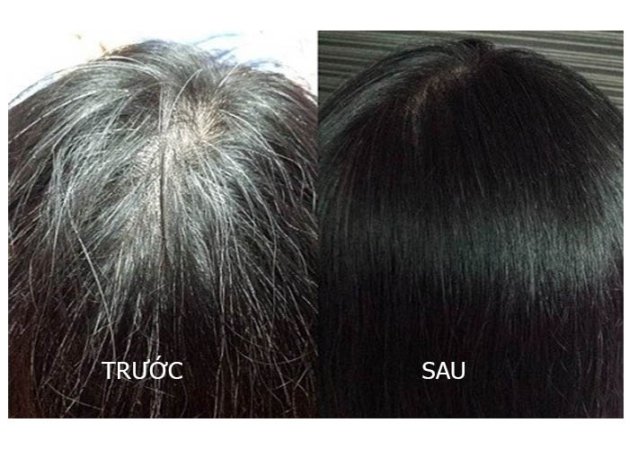 Kem nhuộm tóc collagen kirin - Nhuộm tóc bạc, nhuộm tóc màu đen