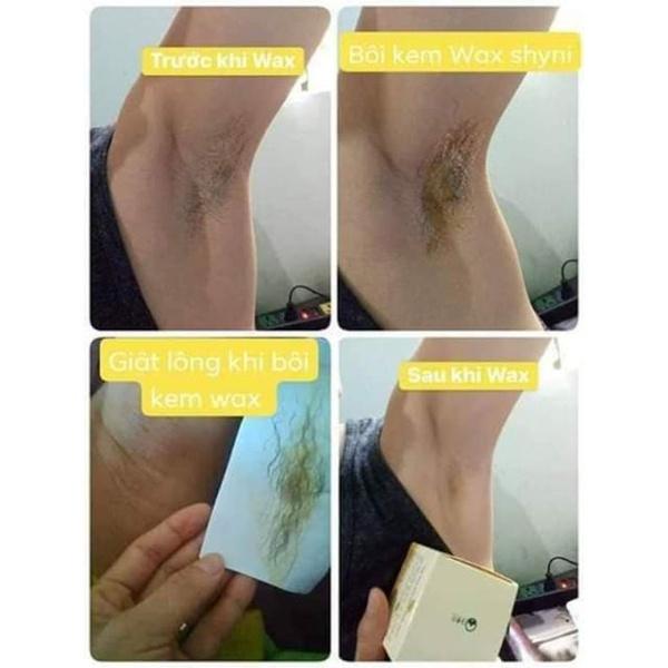 Hình ảnh Combo Triệt lông Wax Shiny và Mỡ Trăn Shiny Handmade