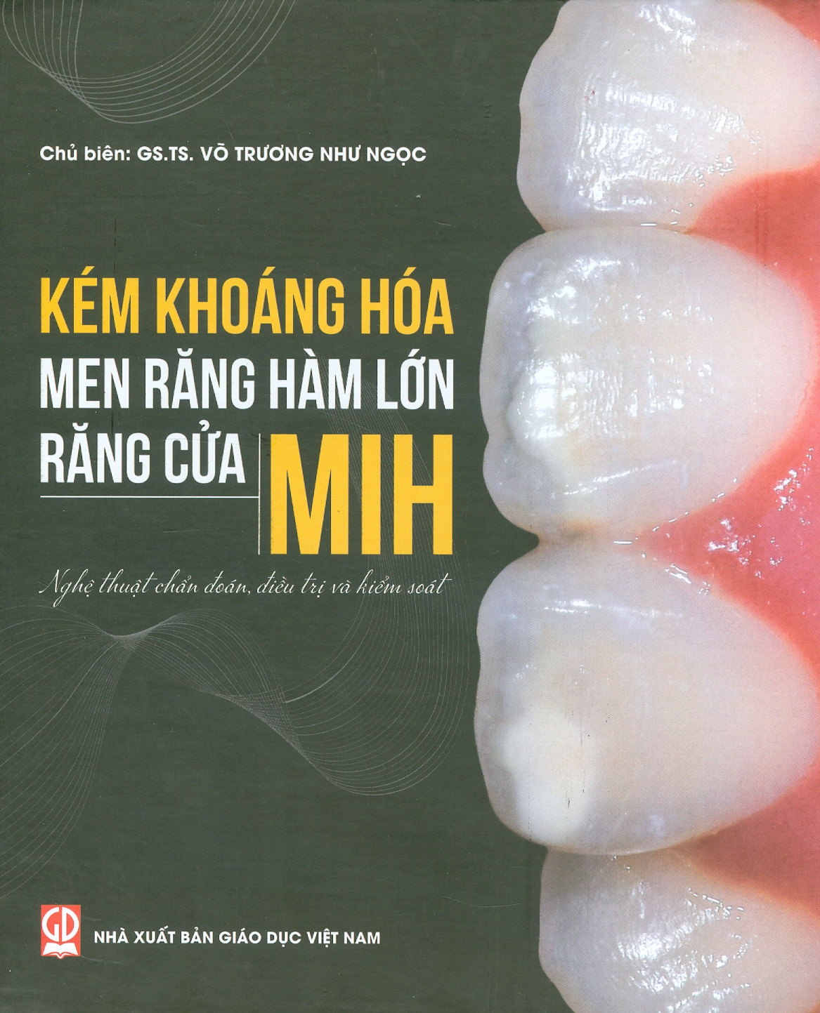Kém Khoáng Hoá Men Răng Hàm Lớn - Răng Cửa MIH: Nghệ Thuật Chẩn Đoán, Điều Tri Và Kiểm Soát (In màu, Bìa cứng)