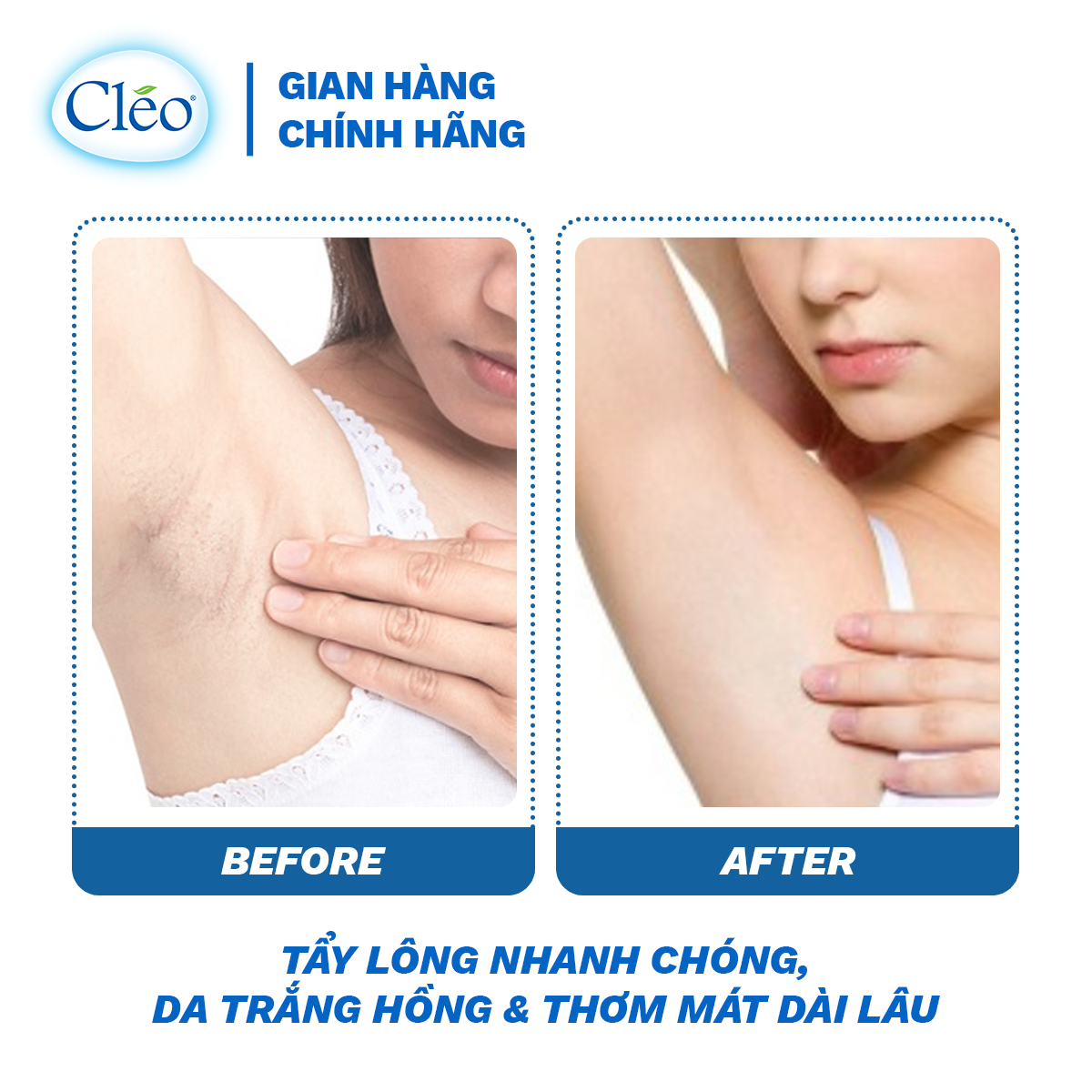 Hình ảnh Kem Tẩy Lông Chiết Xuất Bơ Cleo Dành Cho Da Thường 25g, an toàn, không đau và đạt hiệu quả nhanh chóng