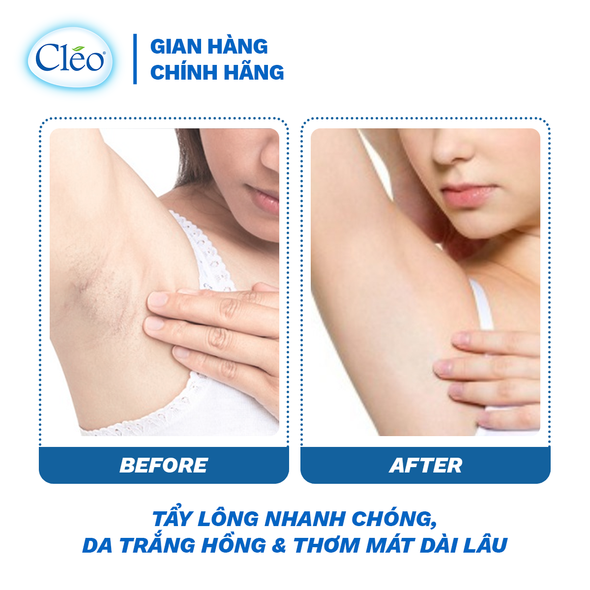 Kem Tẩy Lông Chiết Xuất Bơ Cleo Dành Cho Da Nhạy Cảm 25g, an toàn, không đau và đạt hiệu quả nhanh chóng