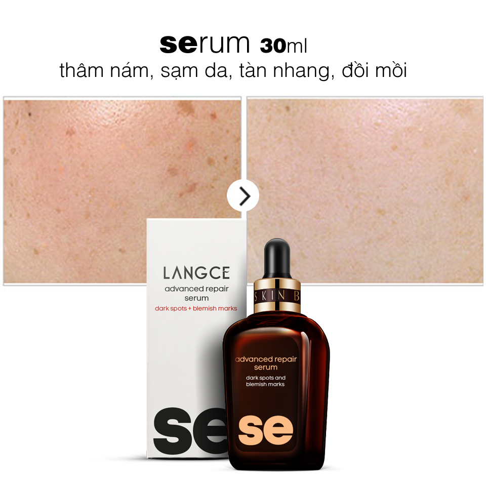 Serum Thâm Nám, Sạm Da, Tàn Nhang, Đồi Mồi 30ml TẶNG Kem Làm Rụng Lông Trắng Da 20ml LANGCE