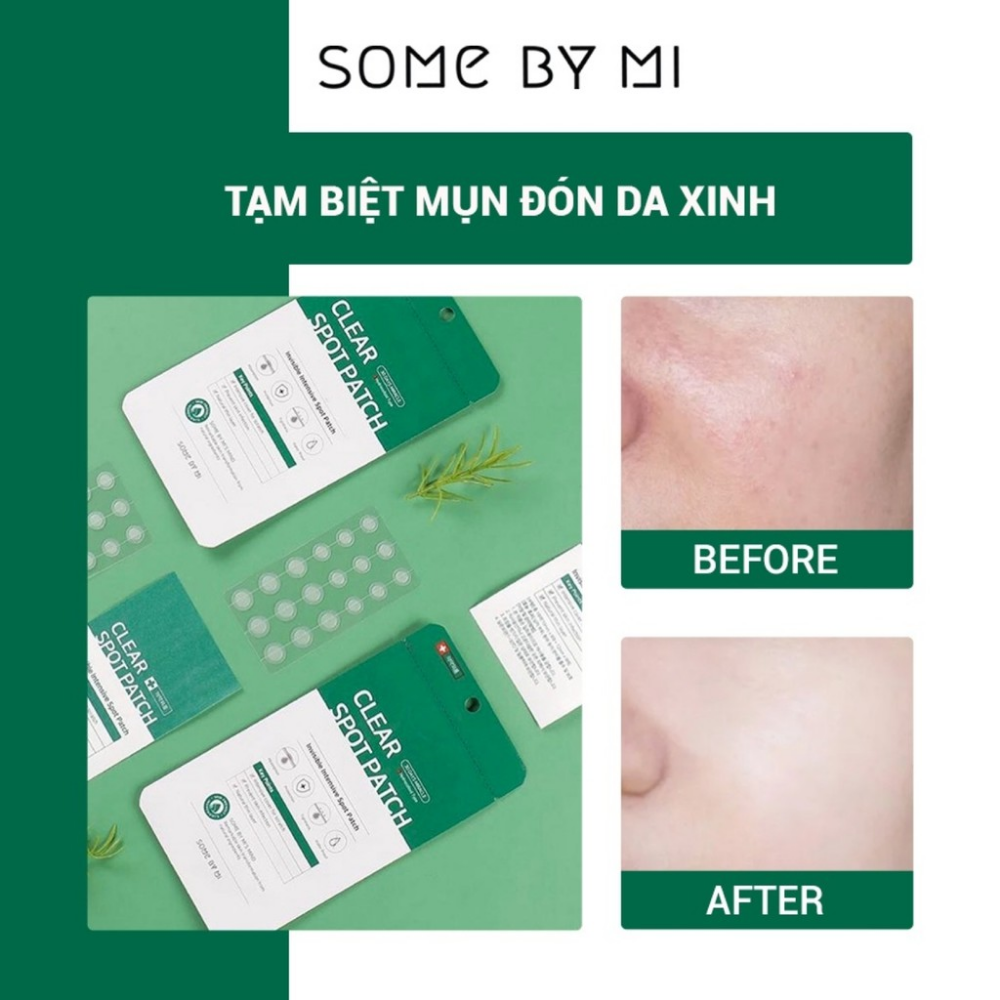 Miếng dán mụn Some By Mi Clear Spot Patch 8g