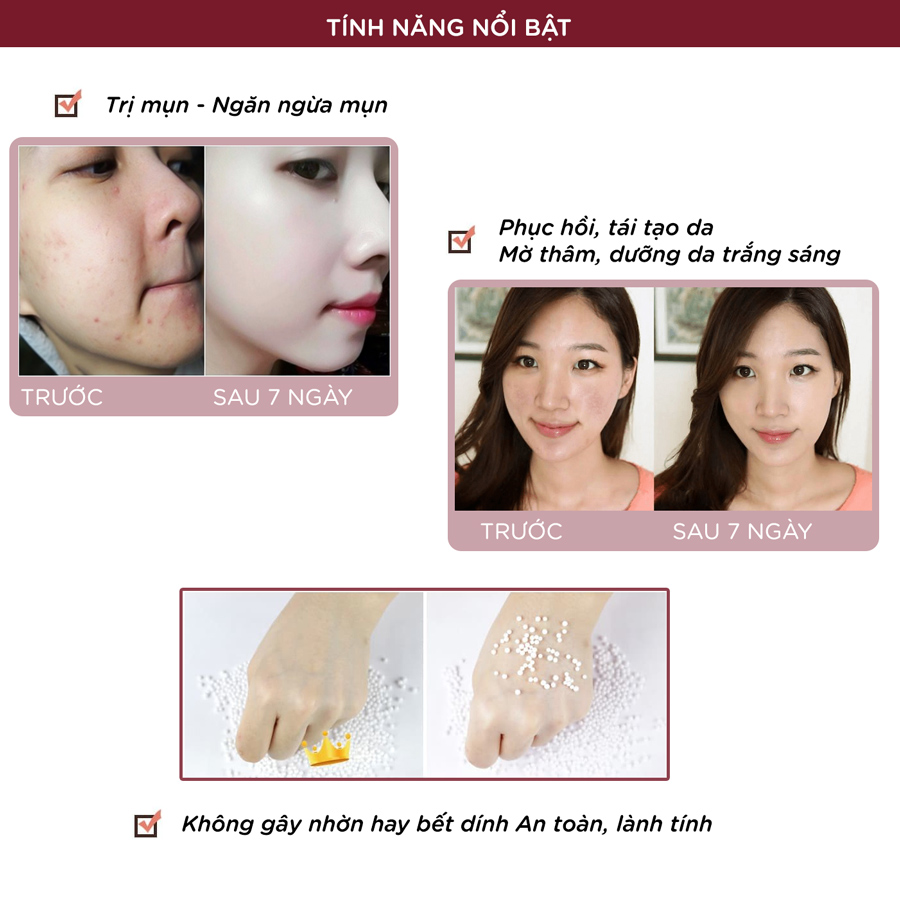 KEM MISSFAIRY LINH CHI 15g - NGĂN NGỪA MỤN - GIẢM THÂM