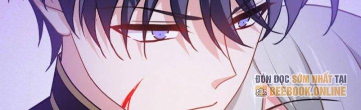 trở thành vương giả sau khi bị cắn chapter 25 134