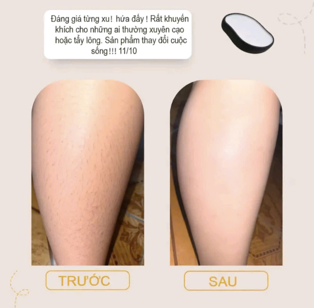 Đá tẩy lông toàn thân và tế bào chết trên da công nghệ mới không đau