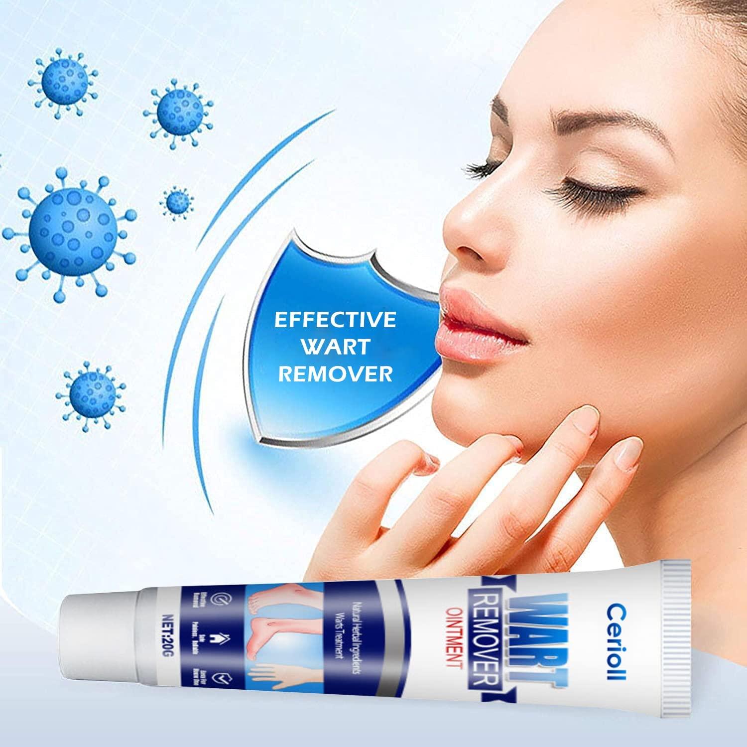 Mụn cóc, Chống mụn cóc ở chân, Không mụn cóc, góc, Chống mụn cóc ở tay/chân, Chống mụn cóc, Ngừng mụn cóc, Chống mụn cóc, Chăm sóc mụn cóc/ngô/chân