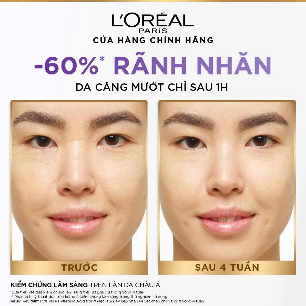 Serum dưỡng cấp ẩm tức thì, giúp làm giảm nếp nhăn &amp; căng mướt da L'Oreal Paris Revitalift 1.5% Hyaluronic Acid 30ml