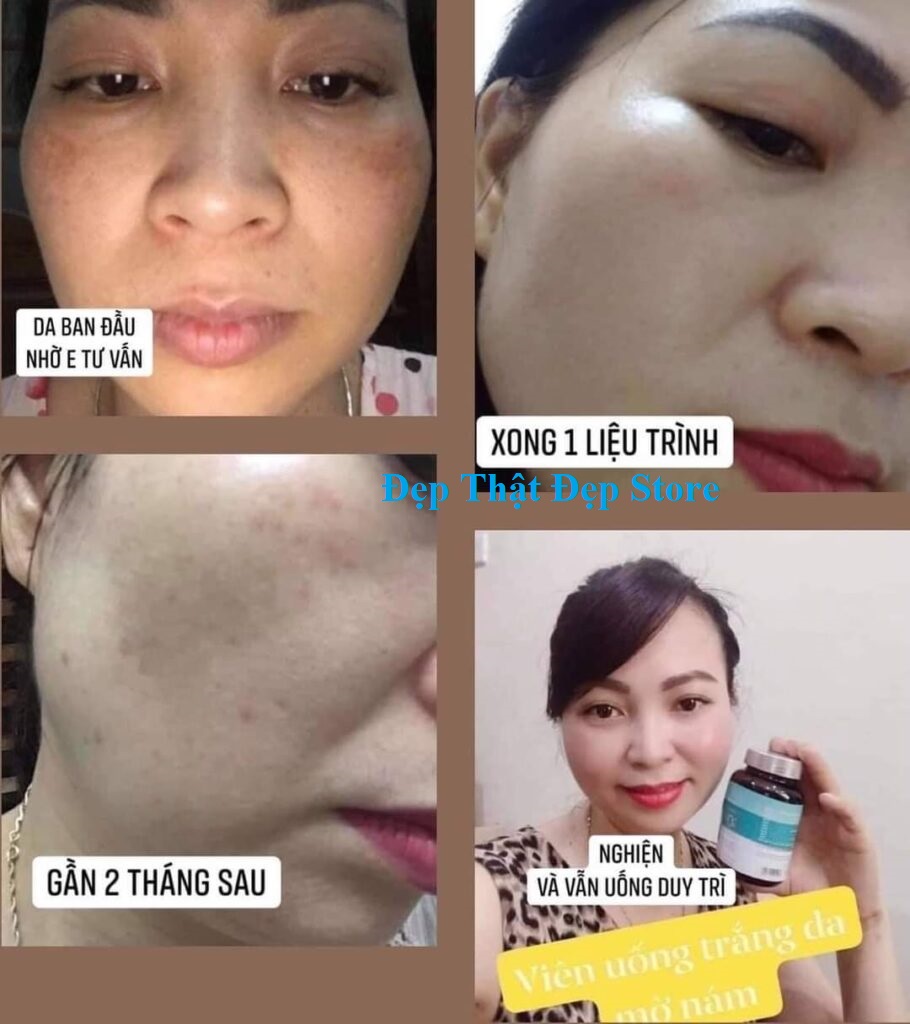 Glutathione 600 - Viên Uống Trắng Da Glutathione Dr.Lacir :Đẹp Da, Mờ Nám, Cân Bằng Nội Tiết Tố