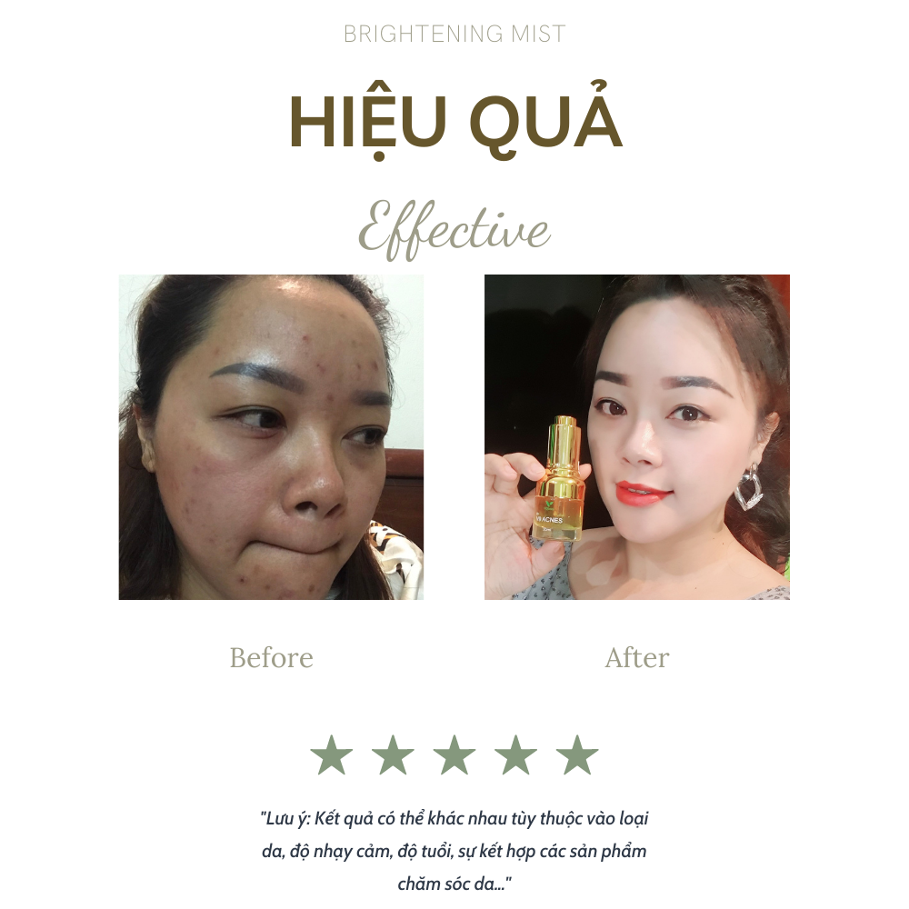 Serum Xóa Mụn V9Queen, Giúp Mờ Thâm Nám Dưỡng Trắng Da 20ml