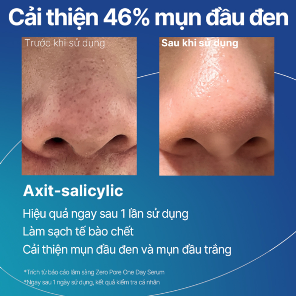 Tinh chất Thu nhỏ lỗ chân lông medicube ZERO PORE ONE DAY SERUM 30ml