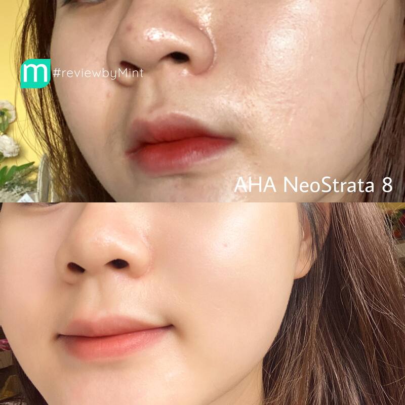 Tẩy da chết hóa học NeoStrata Refine Oily Skin Solution 8 AHA