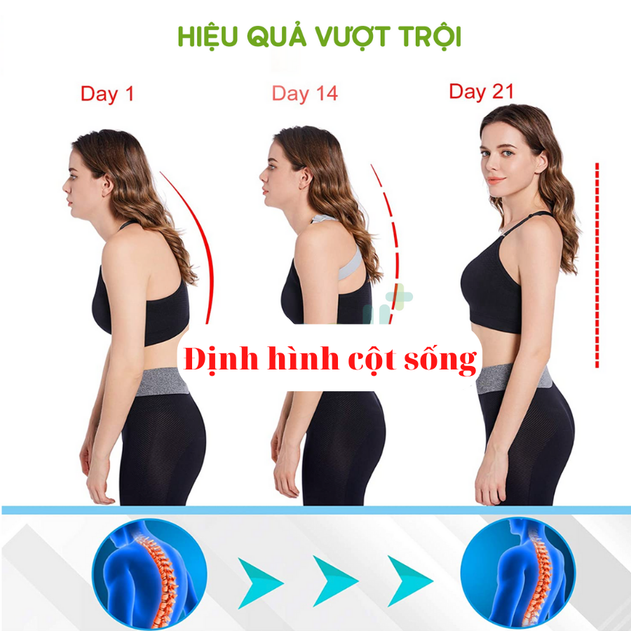 Đai Chống Gù Lưng Có Rung Cảm Biến Ba Chiều Nhắc Nhở Sửa Tư Thế Thông Minh - Nẹp Lưng Chống Gù Cho Trẻ Em và người lớn