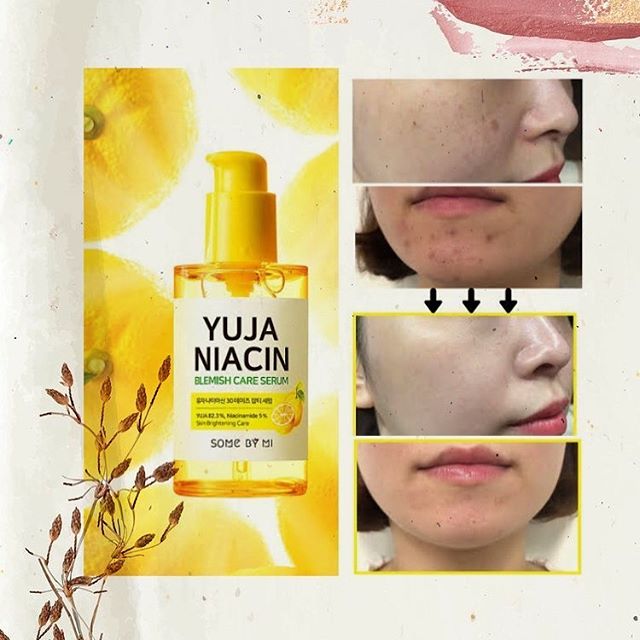 Combo Tinh chất dưỡng trắng Some By Mi Yuja Blemish Care & Kem dưỡng dạng gel Some By Mi Yuja Niacin Brightening Moisture Gel Cream
