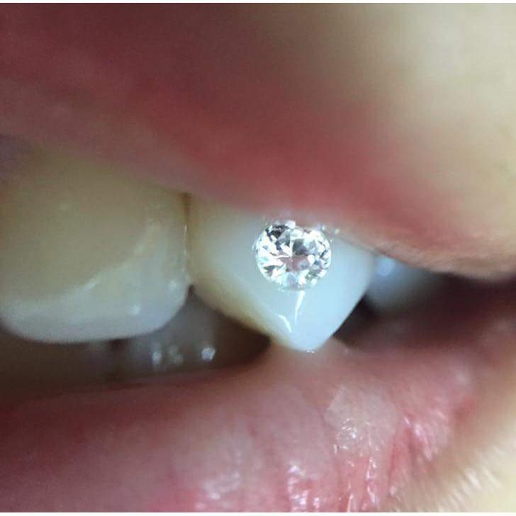 ĐÁ GẮN RĂNG-r87 g50