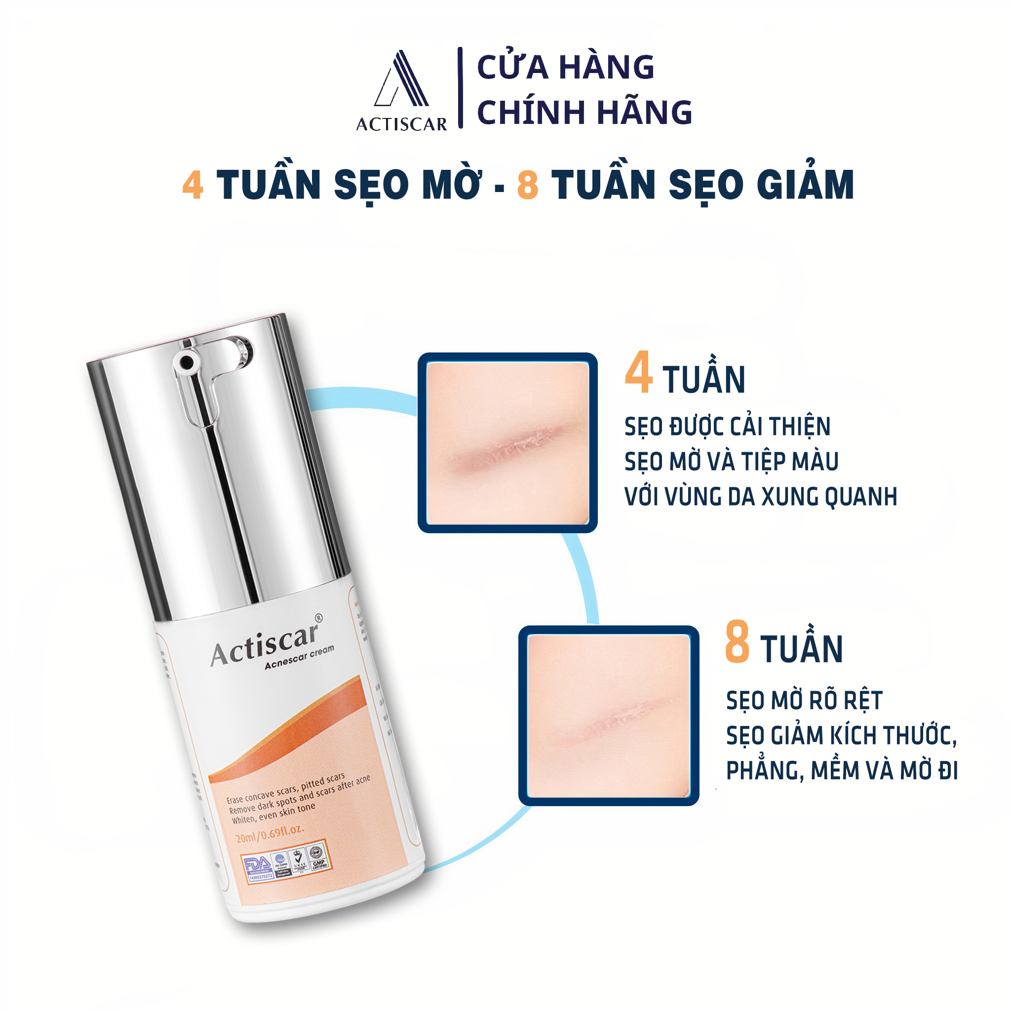 Kem Xóa Sẹo Lõm, Sẹo Rỗ Actiscar 20ml hỗ trợ làm mờ sẹo rỗ, lấp đầy sẹo lõm ( Màu Cam)