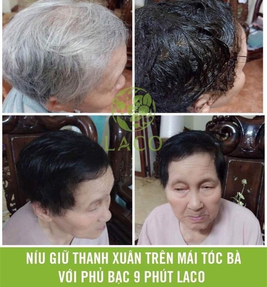 [Chính hãng] Dầu Gội Phủ Bạc Laco Black Hair - Tóc đen tự tin sau 9 phút