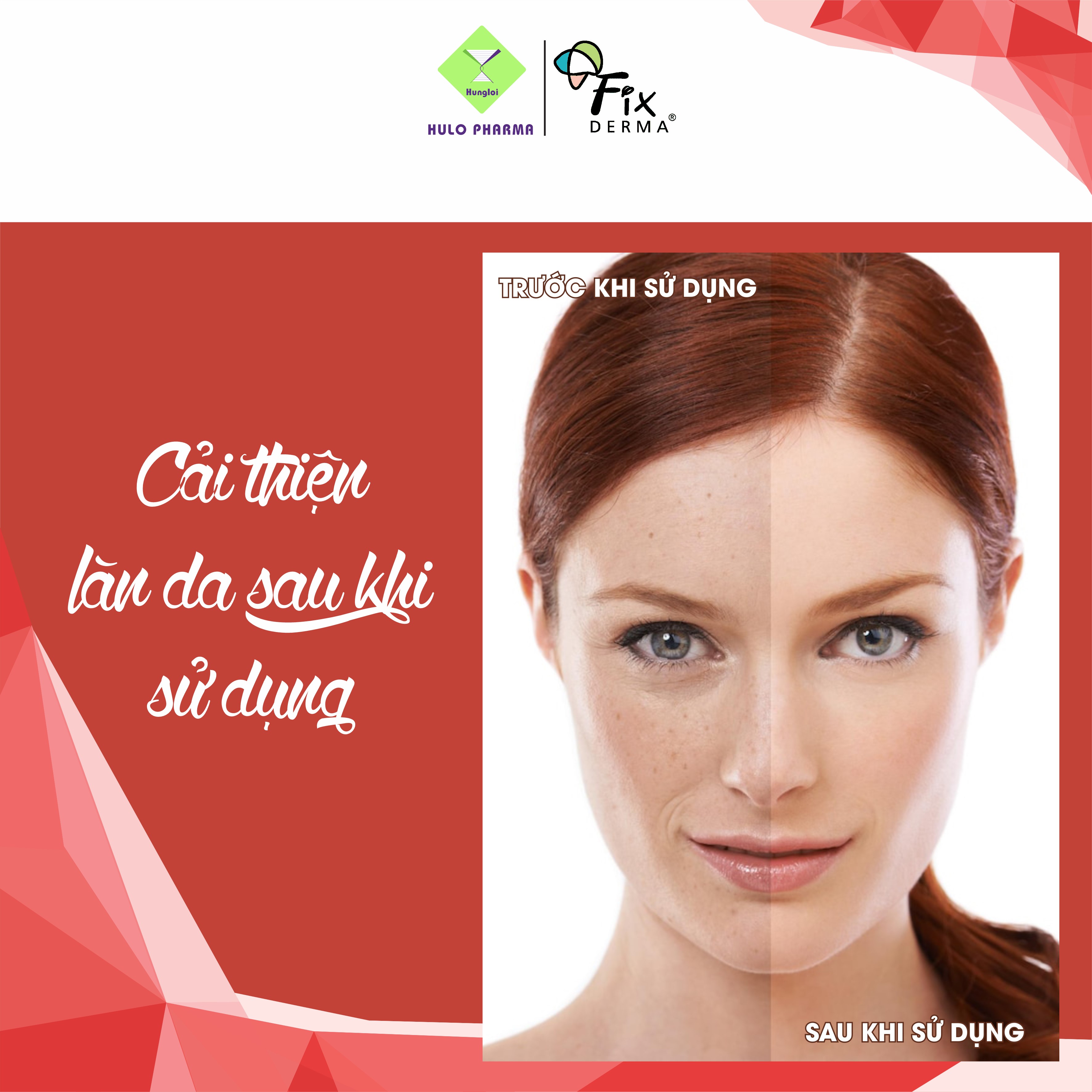 Kem Mờ Thâm Nám FIXDERMA Skarfix - TX Cream Giúp Sáng Da, Loại Bỏ Vết Thâm, Nám, Tàn Nhang, Sẹo, Làm Đều Màu Da 15g