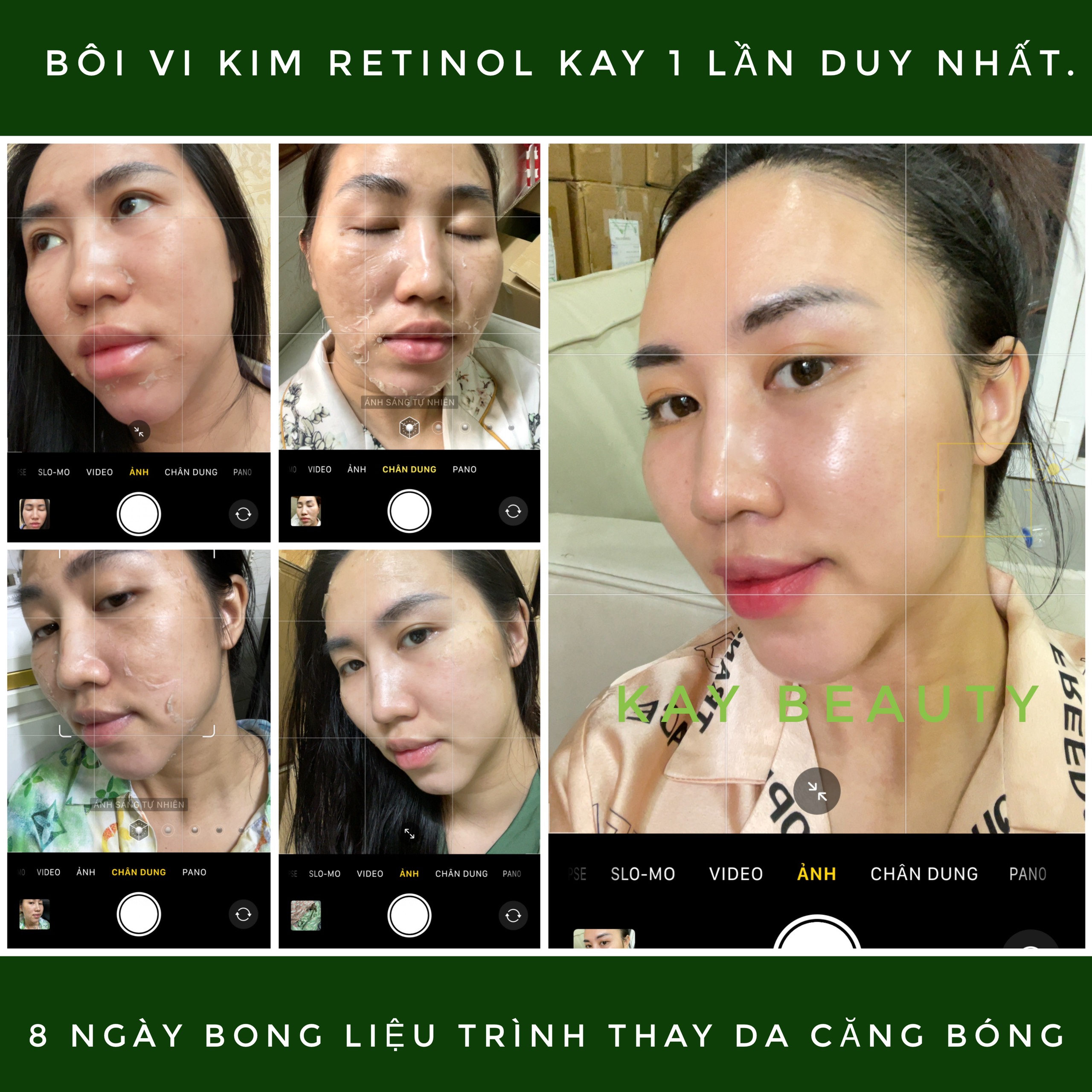 PEEL RETINOL VI KIM TẢO thay mới làn da - không sưng - không đỏ - SEAWEED SKIN REGENERATION HYDRA SERUM B5 KAY BEAUTY - Hộp quà tặng cho chị em