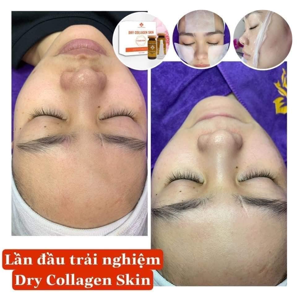 Collagen khô-DRY Collagen -FOURETS COSMETICS-1 ỐNG LẺ